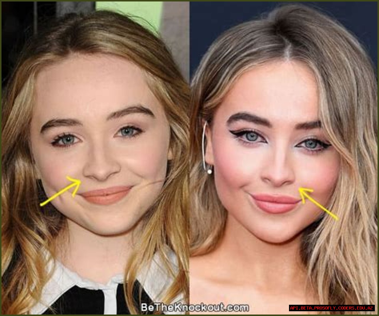 Exploring The Truth: Did Sabrina Carpenter Get A Nose Job?