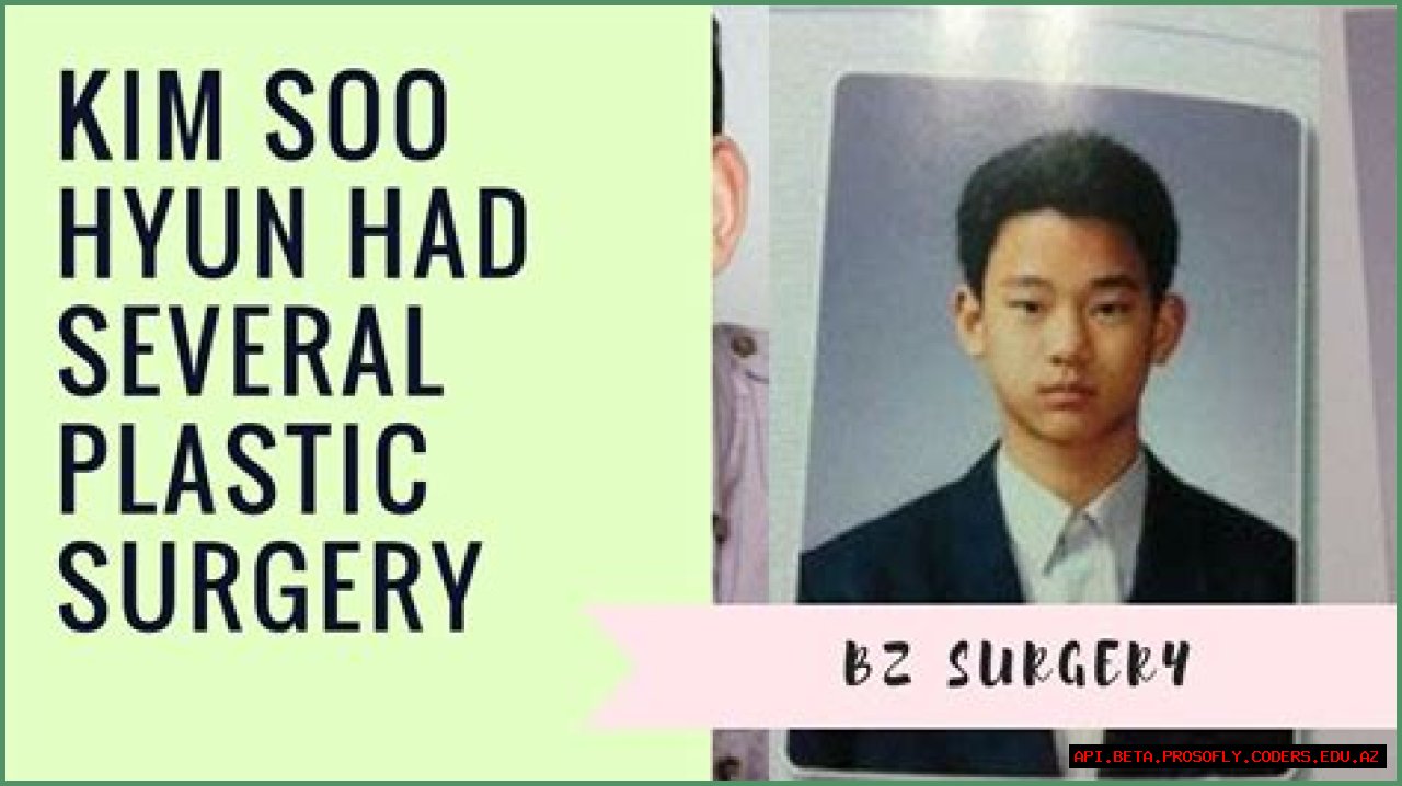 Unveiling The Truth Behind Kim Soo Hyun's Face Surgery